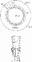 Using the Compression Wheels as a Distance Differential Device! 
<br />By placing one of the hundreds of failed Out of Balance Wheels (OOBW) between the compression wheels (CW1 &amp; 2) it maybe possible to make them work!  
<br />Because of a change of width between t